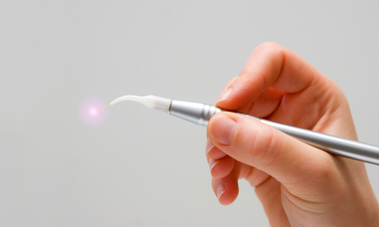 Laser dentistry is generally safe and effective, but it's important to understand how it works, its benefits, and any potential risks.