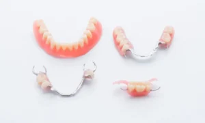 Options to Replace Missing Teeth in Chicago, IL