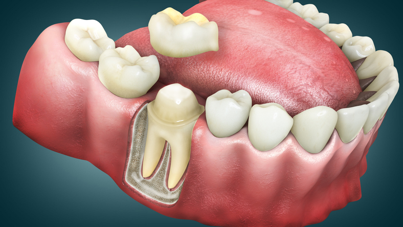 The Chicago Commuter's Guide to Dental Crowns: How to Fit Treatment Into a Busy Schedule